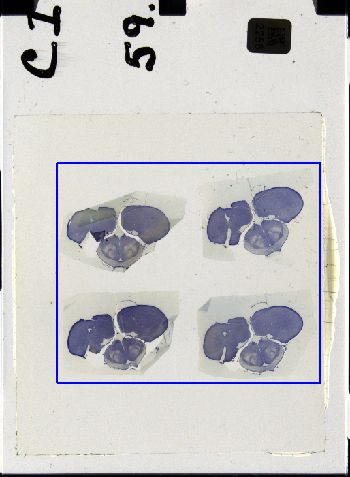 Media type: image; Special Collections 3298   shows specimen_part histological serial section;